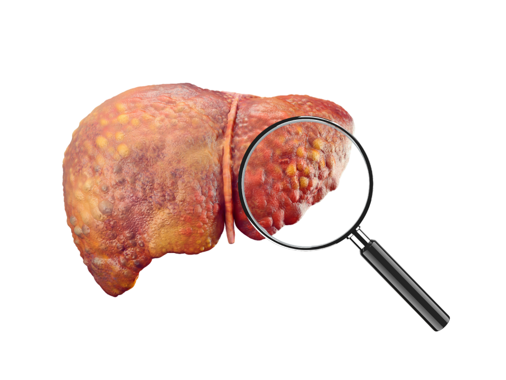 Diagnosis of Acute Hepatitis