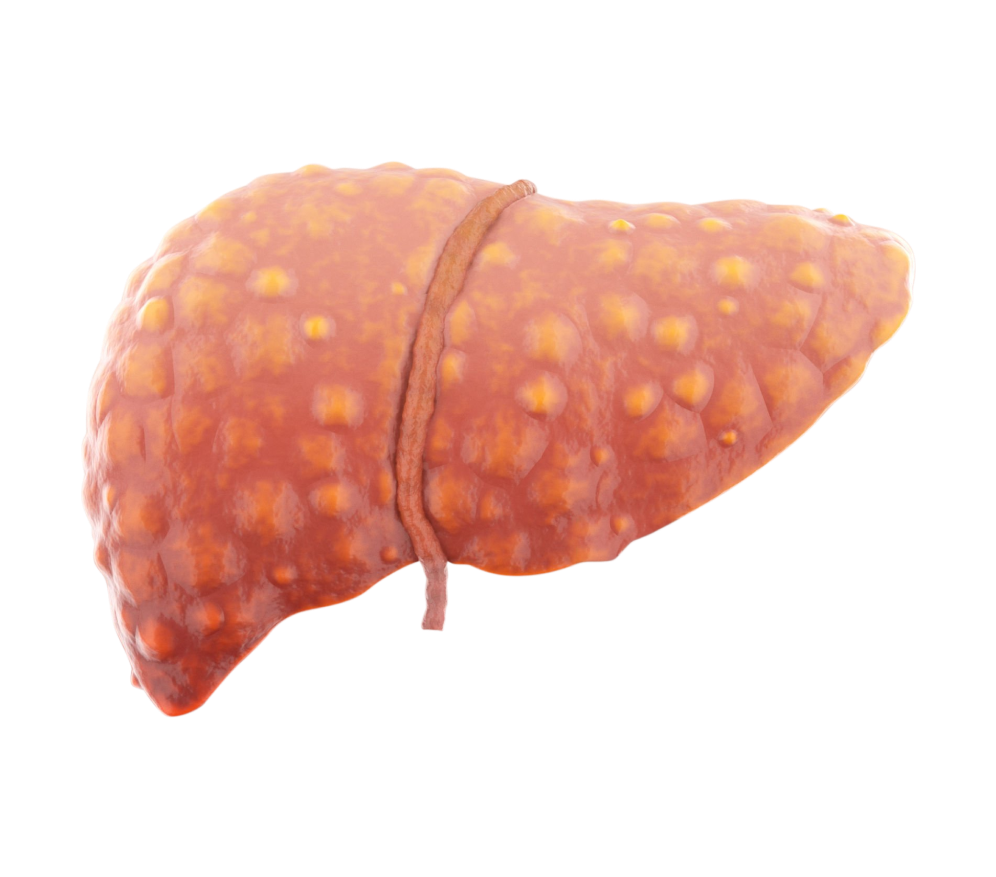 Chronic Hepatitis Treatment Overview