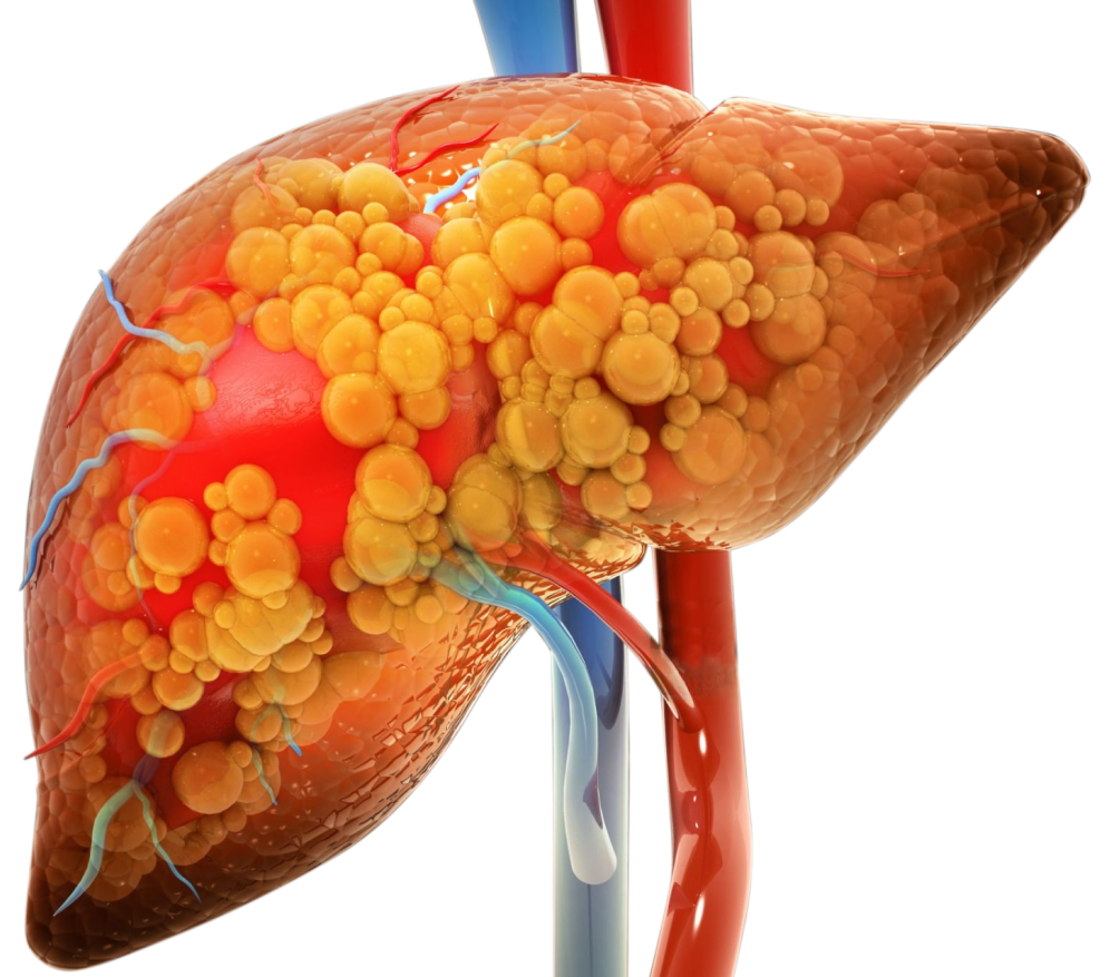Causes of Chronic Hepatitis