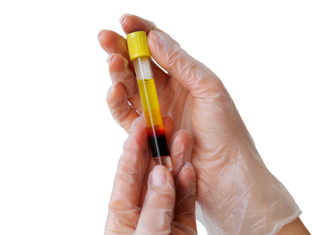 Diagnosis of Chronic Hepatitis