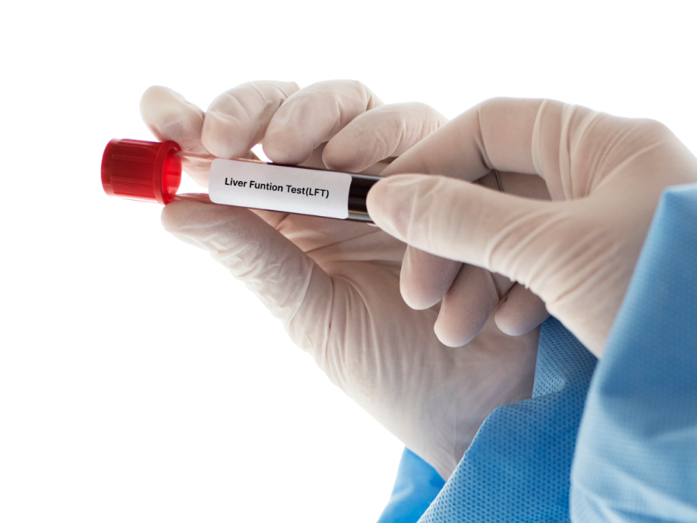 Diagnosis of Liver Cirrhosis
