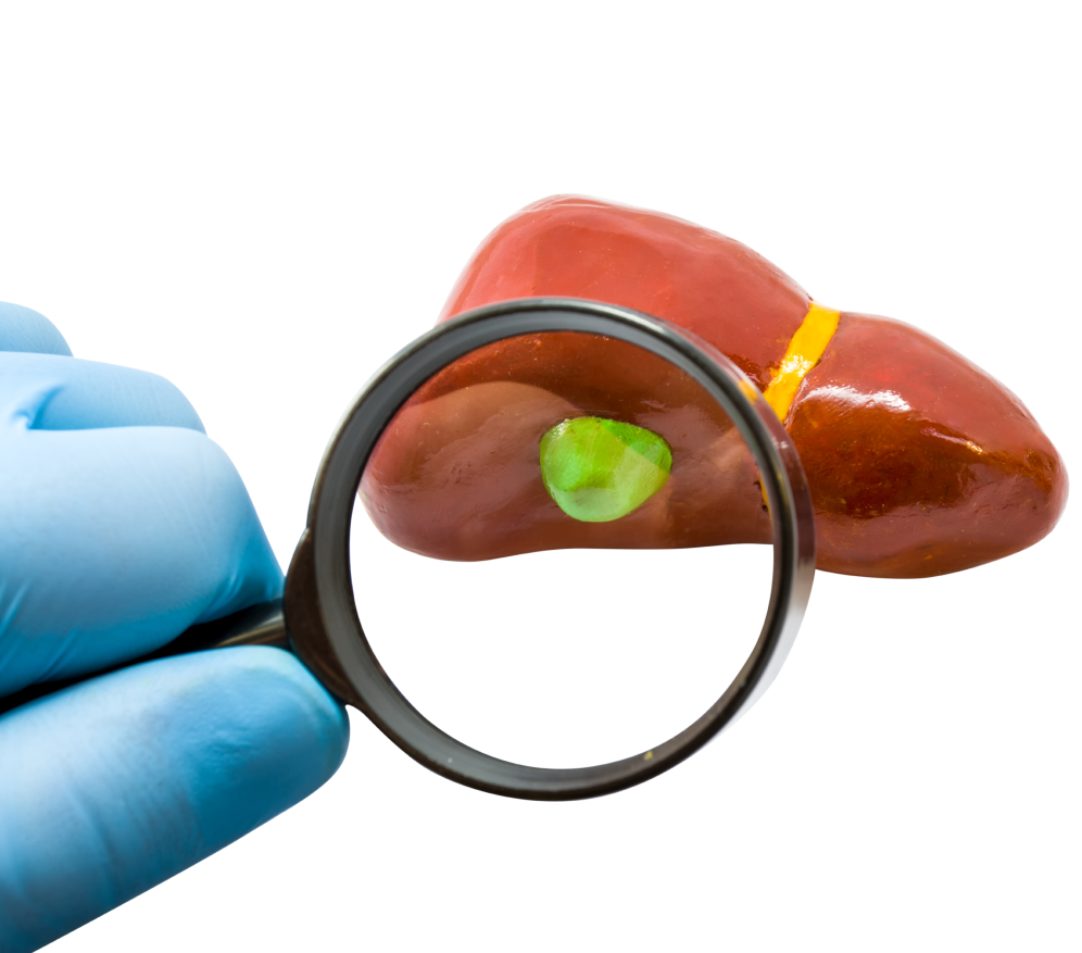 Pre-evaluation of Bile Duct Cancer Surgery