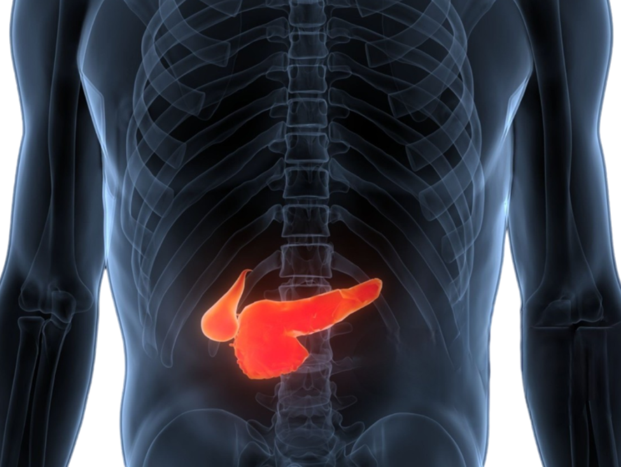 What is Whipple Surgery