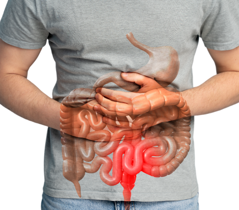 Gastrointestinal GI Surgery Overview