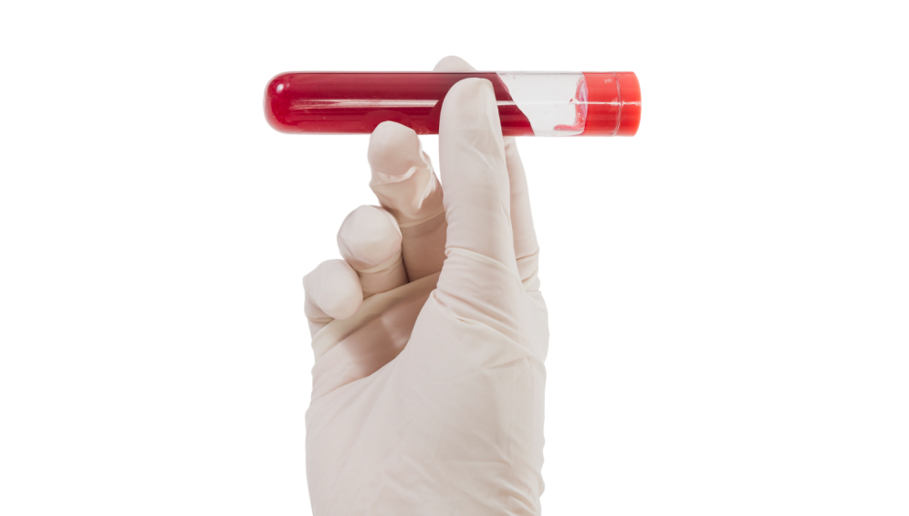 Preoperative Liver Transplant Testing